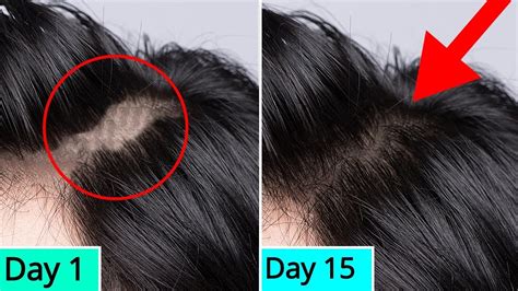 Say GoodBye To Hair Fall Hair Loss Hair Breakage Regrow Hair From