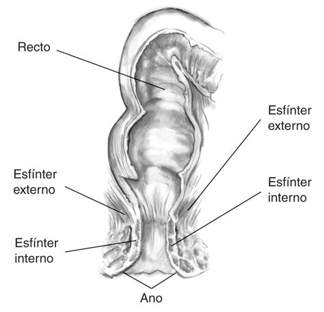 Hipotonia Do Esfincter Inferior Do Es Fago Braincp