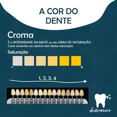 Sele O De Cor Em Odontologia Como Escolher A Resina