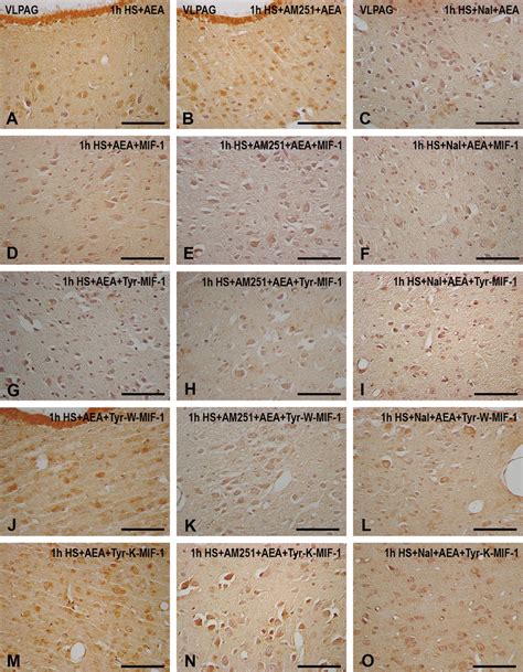 Immunohistochemical Expression Of Cb1 Receptors In Some Small Sized Download Scientific Diagram