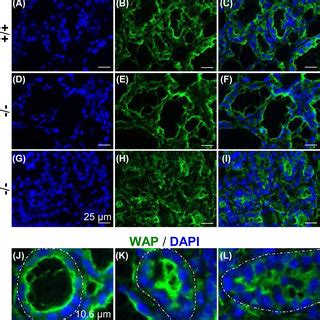 Detection Of Lipid Droplets In Ld Mammary Glands Using Nile Red