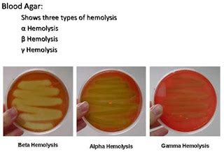 Hemolysis Types - Microbiology Lab Notes