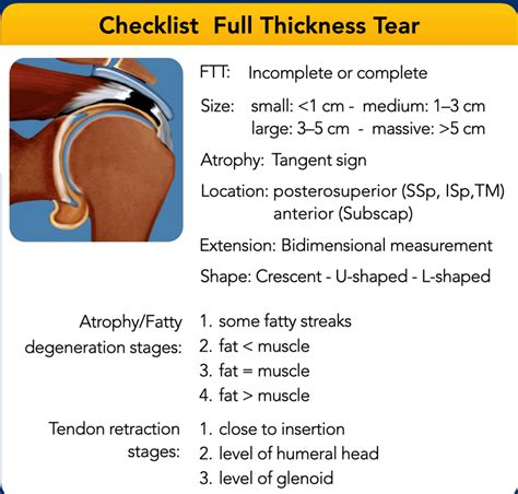 Rotator Cuff Tendonitis Vs Tear Hot Sex Picture