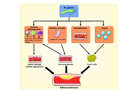 Different Pathways Through Which H Pylori May Promote Atherosclerotic