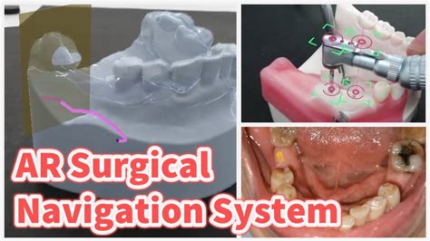 Advanced Surgical Navigation System Using Augmented Reality Technology