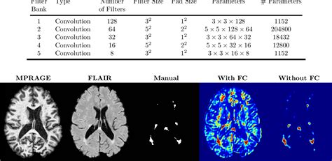 Figure 2 From Multiple Sclerosis Lesion Segmentation From Brain Mri Via Fully Convolutional