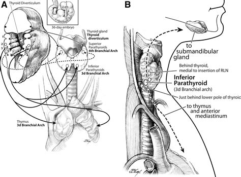 Reoperative Parathyroid Surgery Operative Techniques In