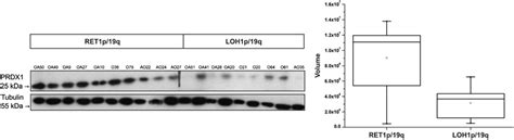 Prdx Protein Expression Is Decreased In Gliomas With Allelic Losses On