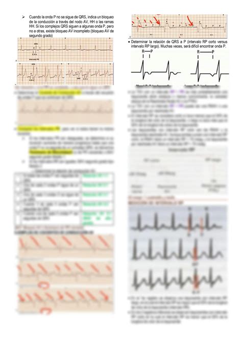 Solution Tema Electrocardiograf A Abordaje Diagn Stico De Las