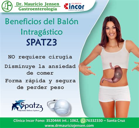 Beneficios Del Bal N Intrag Strico Dr Mauricio Jensen Medico