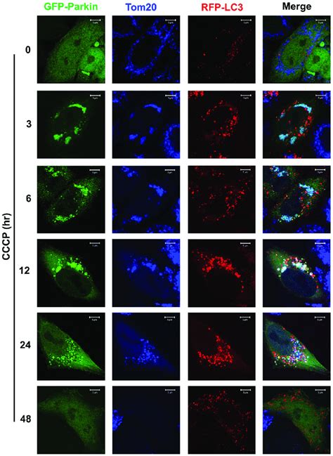 Colocalization Among Parkin Tom Indicated Mitochondria And