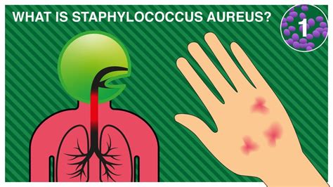 STAPHYLOCOCCUS AUREUS - Pal International