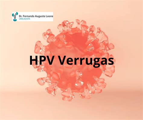 HPV Verrugas Dr Fernando Leone Urologista BH BH