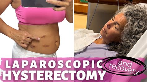 My Laparoscopic Hysterectomy Story And Recovery Surgical Menopause What To Expect Youtube