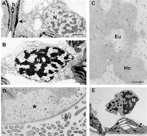 Ultrastructural Changes In Oat Mesophyll Cells During Bacterial