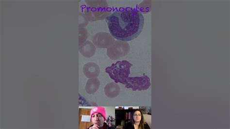 Promonocyte Morphological Characteristics - YouTube