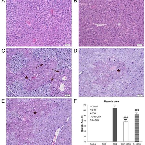 Effect Of Chrysin On Histological Changes In The Liver Of Ccl