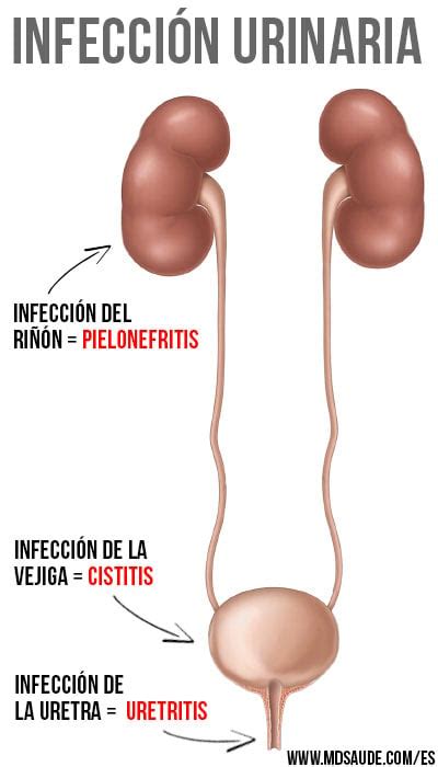 10 síntomas de la infección urinaria MD Saúde