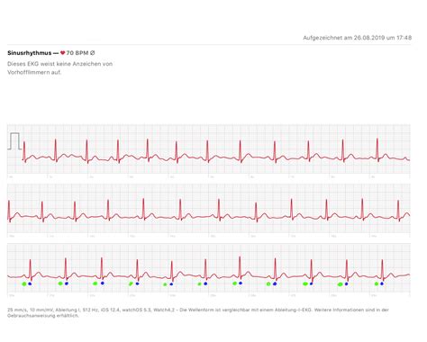 Gesundes Ekg Frau Deals Innoem Eng Psu Ac Th