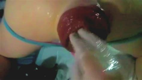 Russian Anal Prolapse Russian Gay Pigs Speaking Thisvid