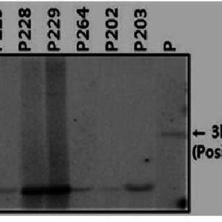 Northern Blot Hybridization Analysis Of Transgenic Cucumber Carrying