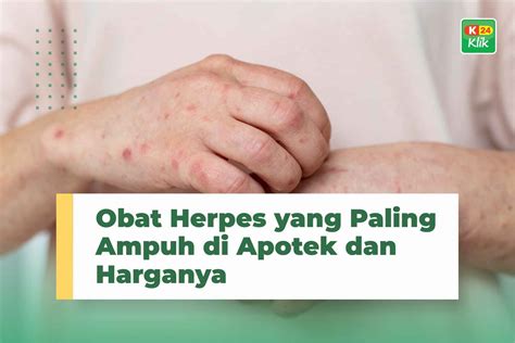 Obat Herpes Kulit Di Apotik Homecare