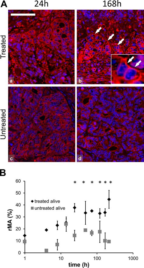 Hsp Immunofluorescence Alexa Red And Semi Quantitative