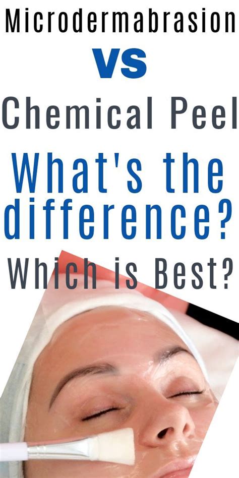 Microdermabrasion Vs Chemical Peel Which Is Right For You Artofit