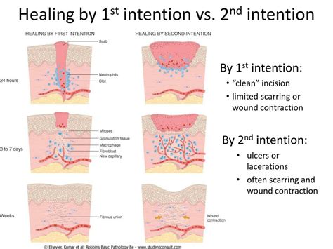 Wound Reopened After Stitches Removed Symptoms Risk Factors