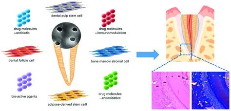 Treated Dentin Matrix Based Bio Root Construction Ab Alveolar Bone