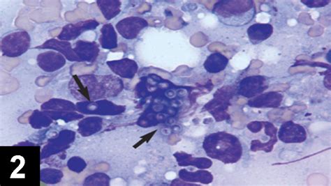 Lymph Node Cytology Clinicians Brief