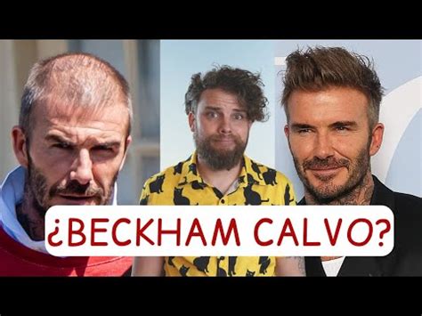 David Beckham Est Calvo Se Ha Hecho Trasplante De Pelo Youtube