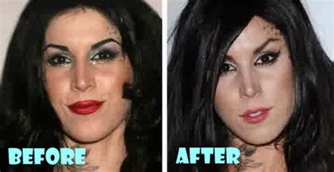 Kat Von D Plastic Surgery Before and After - Lovely Surgery | Celebrity ...