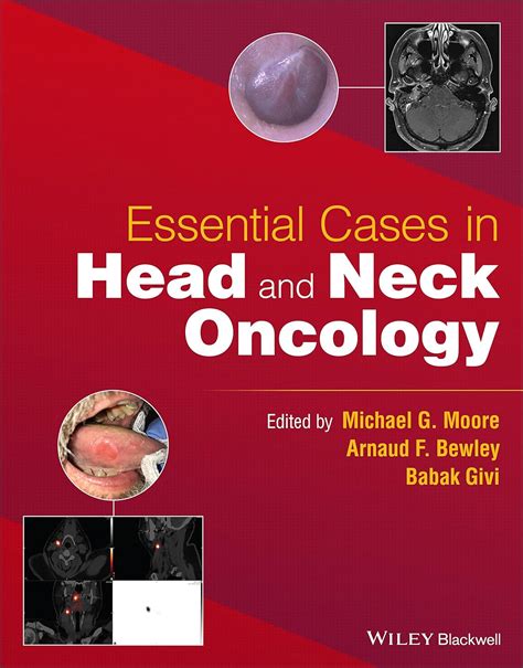 Amazon Essential Cases In Head And Neck Oncology Moore Michael G