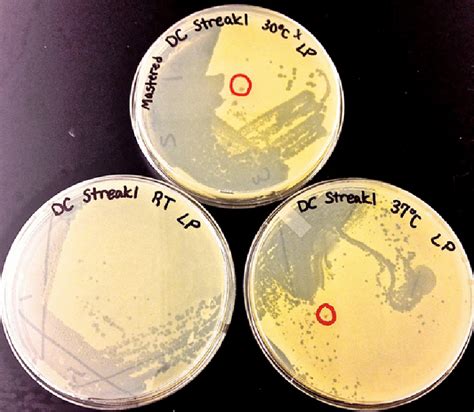 E Coli Streak Plate