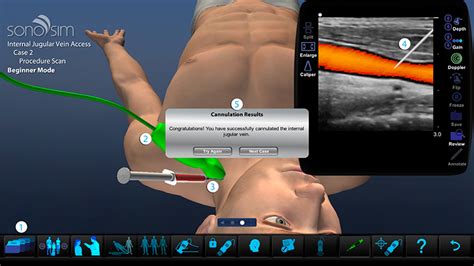 Sonosimulator Features Ultrasound Simulator Sonosim