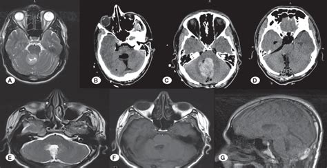 A The Axial Section Of The Cranial T2w Magnetic Resonance Imaging