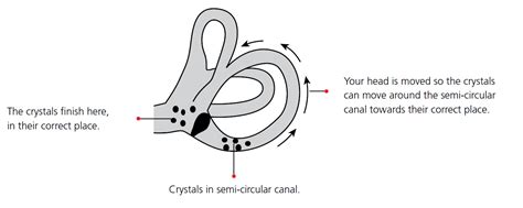 In Your Ear Crystals Symptoms