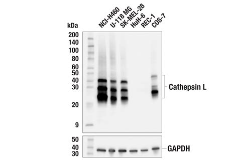 Cathepsin L E3R3P Rabbit MAb Cell Signaling Technology