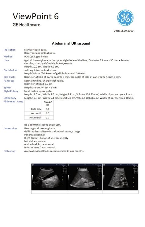 Viewpoint 6 Direct Connect For Radiology Ge Healthcare