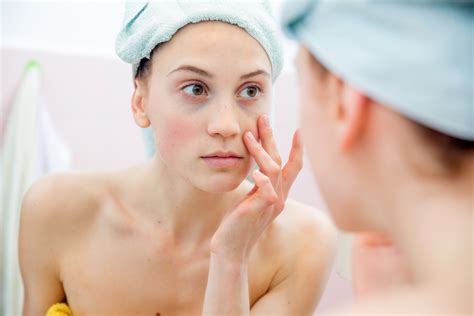 The Best Skincare Routine For Rosacea A Go To Guide For Care And