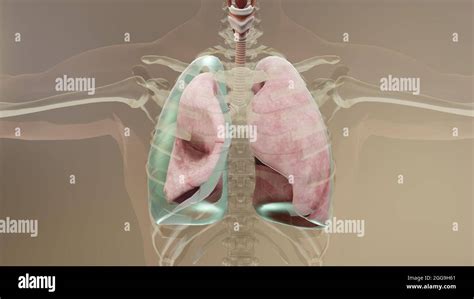 D Illustration Of Pneumothorax Normal Lung Versus Collapsed Symptoms