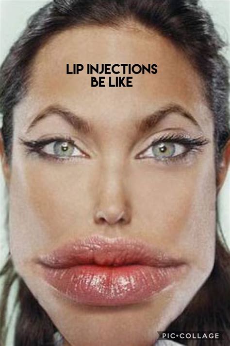 Pin by Lovablecow:) on ☻ just funny ☻ | Lip injections, Lips, Injections