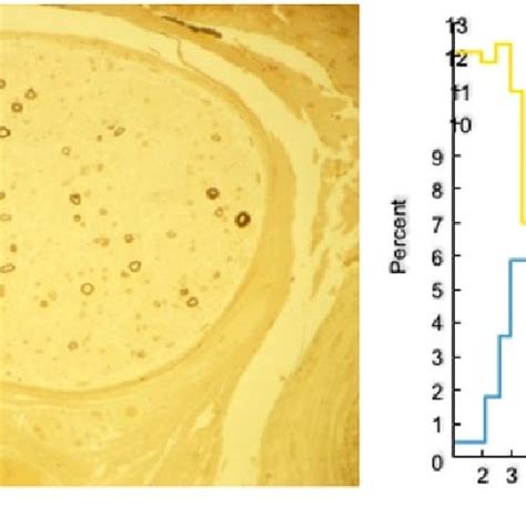 Overview Of Axon Regeneration In Mammals After Axon Injury The