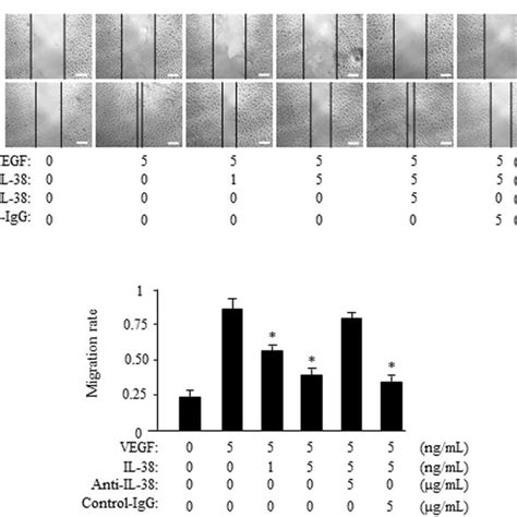 IL-38 reduces endothelial cell migration. (a) The effect of IL-38 on ...