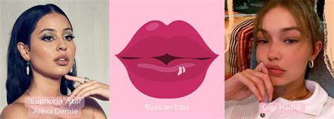 Russian Lips Cost Side Effects Before And After More Urban You