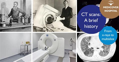 History of CT scan – H Medical