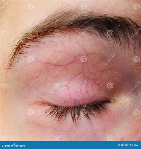 Eyelid With Blood Vessels Veins Stock Image Image Of White Closeup