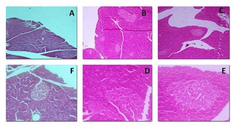 Estudio Histopatol Gico Pancre Tico Control A X Y F X