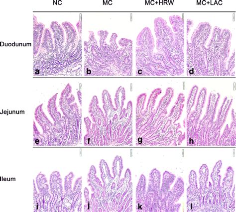 Morphological And Molecular Response Of Small Intestine To Lactulose